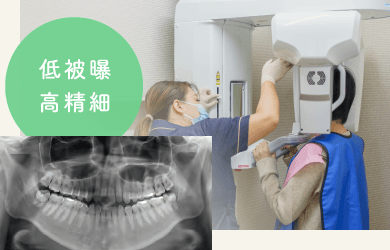 低被曝・高精細