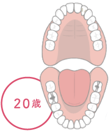 20歳