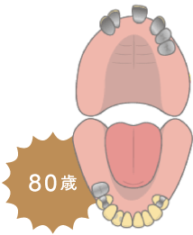 80歳