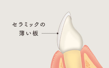 セラミックの薄い板