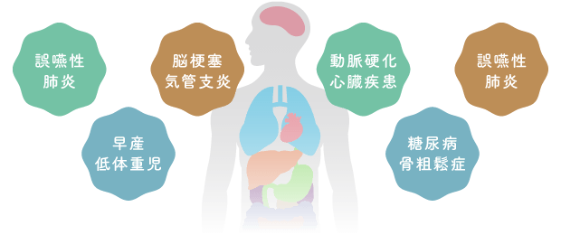 誤嚥性肺炎、早産低体重児、脳梗塞気管支炎、動脈硬化心臓疾患、糖尿病骨粗鬆症、誤嚥性肺炎
