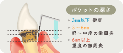 ポケットの深さ