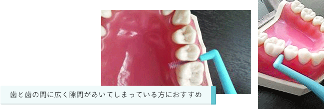 指に巻いて歯と歯の間に通す方法が一般的